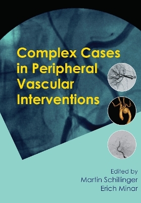 Complex Cases in Peripheral Vascular Interventions - 