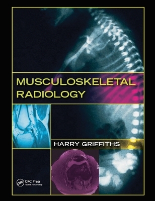 Musculoskeletal Radiology - Harry Griffiths