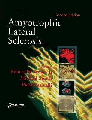 Amyotrophic Lateral Sclerosis, Second Edition - 