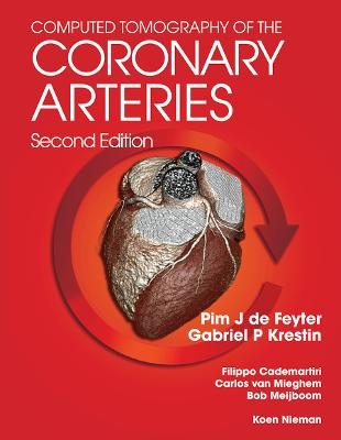 Computed Tomography of the Coronary Arteries - 