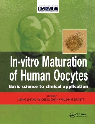 In Vitro Maturation of Human Oocytes - 