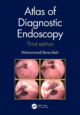 Atlas of Diagnostic Endoscopy, 3E - Mohammad Ibrarullah