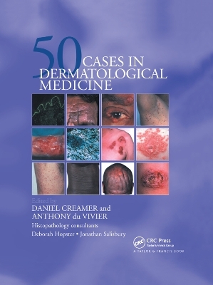 Fifty Dermatological Cases - Daniel Creamer, Anthony du Vivier