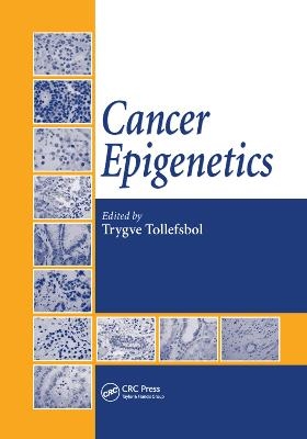 Cancer Epigenetics - 