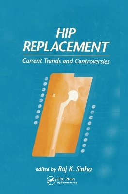 Hip Replacement - Raj K. Sinha