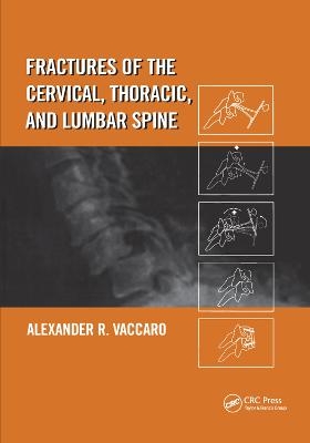 Fractures of the Cervical, Thoracic, and Lumbar Spine - Alexander R. Vaccaro