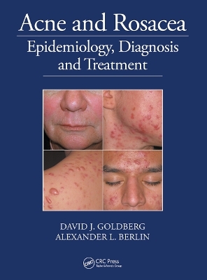 Acne and Rosacea - David Goldberg, Alexander Berlin