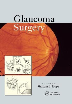 Glaucoma Surgery - 