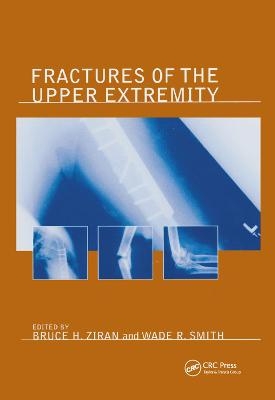 Fractures of the Upper Extremity - 