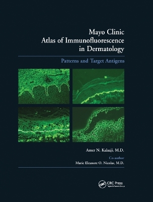 Mayo Clinic Atlas of Immunofluorescence in Dermatology - Amer N. Kalaaji, Marie E.O. Nicolas
