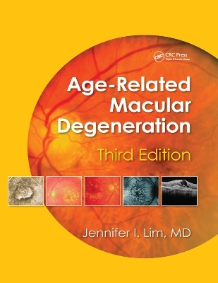 Age-Related Macular Degeneration, Third Edition - 