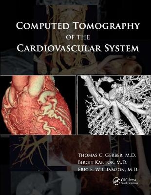 Computed Tomography of the Cardiovascular System - 