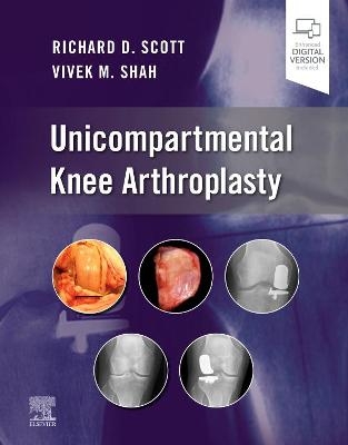 Unicompartmental Knee Arthroplasty - Richard D. Scott, Vivek Shah