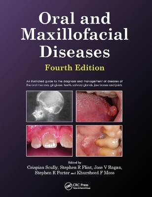 Oral and Maxillofacial Diseases, Fourth Edition - Crispian Scully, Stephen Flint