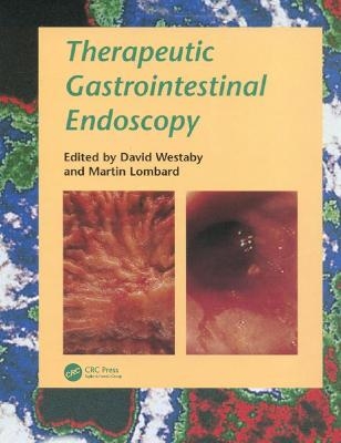 Therapeutic Gastrointestinal Endoscopy - 