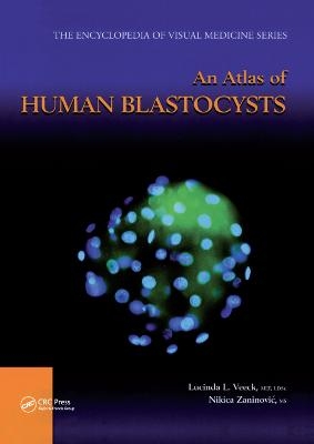 An Atlas of Human Blastocysts - Lucinda L. Veeck, Nikica Zaninovic