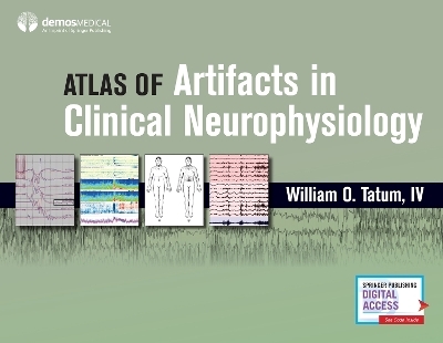 Atlas of Artifacts in Clinical Neurophysiology - William Tatum