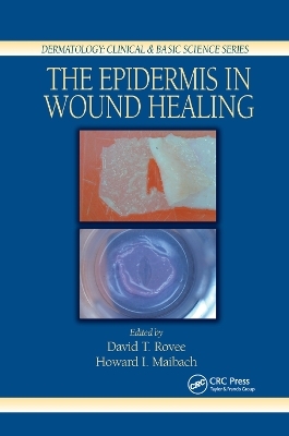 The Epidermis in Wound Healing - 