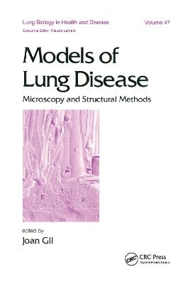 Models of Lung Disease - Joan Gil