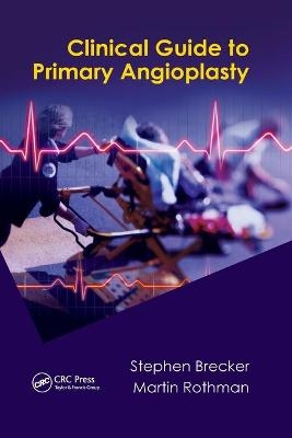 Clinical Guide to Primary Angioplasty - 