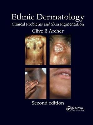 Ethnic Dermatology - 