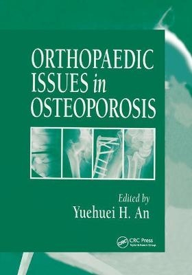 Orthopaedic Issues in Osteoporosis - 