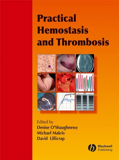 Practical Hemostasis and Thrombosis - 