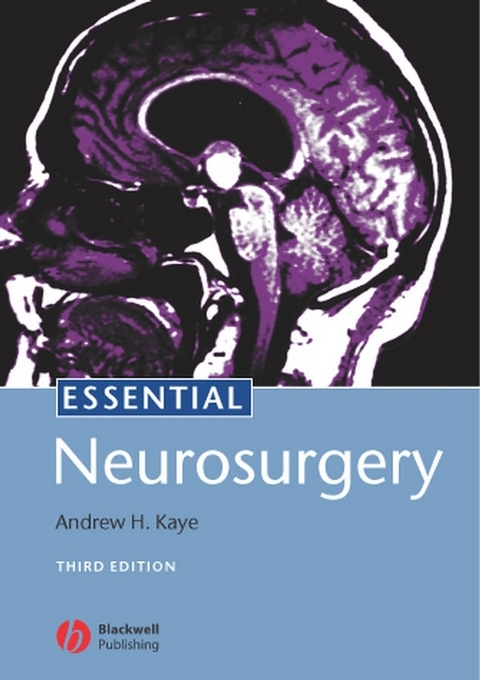 Essential Neurosurgery -  Andrew H. Kaye