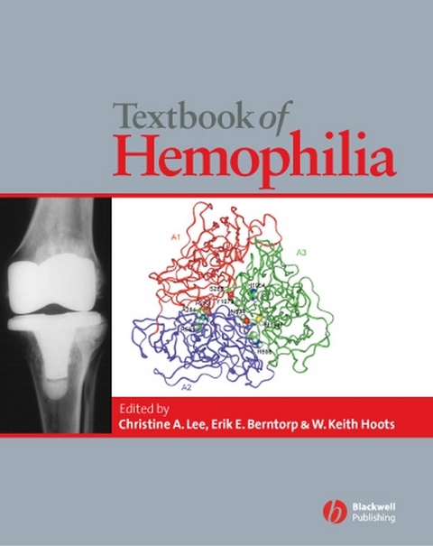 Textbook of Hemophilia - 