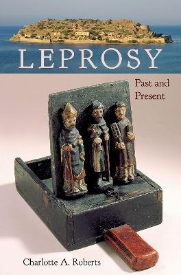 Leprosy - Charlotte A. Roberts