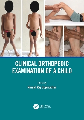 Clinical Orthopedic Examination of a Child - 