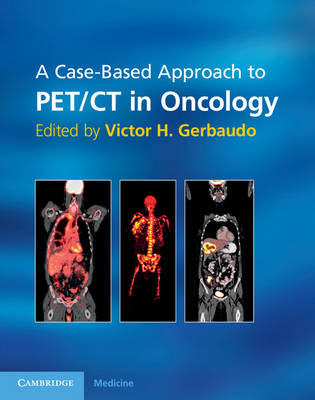 Case-Based Approach to PET/CT in Oncology - 