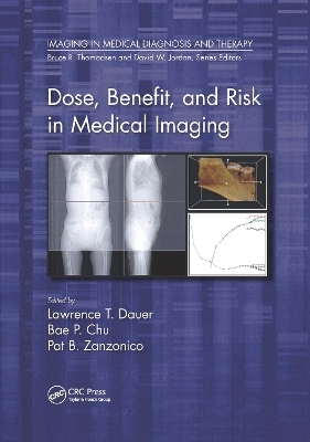 Dose, Benefit, and Risk in Medical Imaging - 