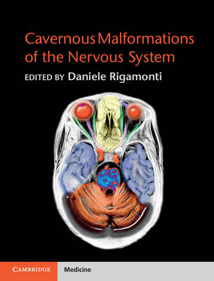 Cavernous Malformations of the Nervous System - 