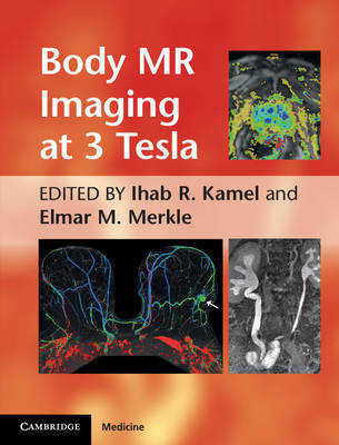 Body MR Imaging at 3 Tesla - 