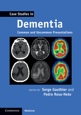 Case Studies in Dementia: Volume 1 - 