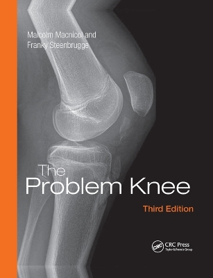 The Problem Knee - Malcolm F. Macnicol, Malcolm Macnicol, Franky Steenbrugge