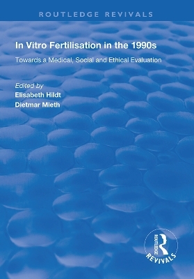 In Vitro Fertilisation in the 1990s - 