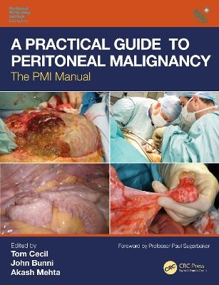 A Practical Guide to Peritoneal Malignancy - 