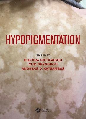 Hypopigmentation - 
