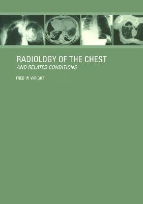 Radiology of the Chest and Related Conditions - F W Wright