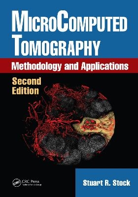 MicroComputed Tomography - Stuart R. Stock