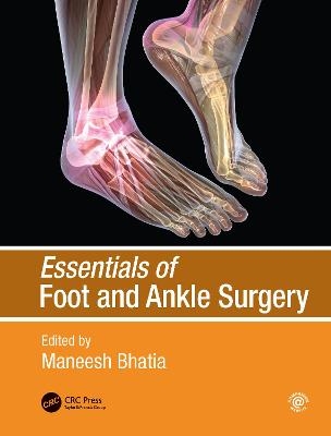 Essentials of Foot and Ankle Surgery - 