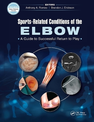 Sports-Related Conditions of the Elbow - Anthony Romeo, Brandon Erickson