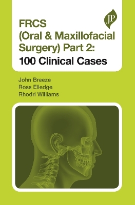 FRCS (Oral & Maxillofacial Surgery) Part 2: 100 Clinical Cases - John Breeze, Ross Elledge, Rhodri Williams
