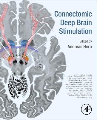 Connectomic Deep Brain Stimulation - 