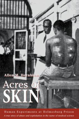 Acres of Skin -  Allen M. Hornblum