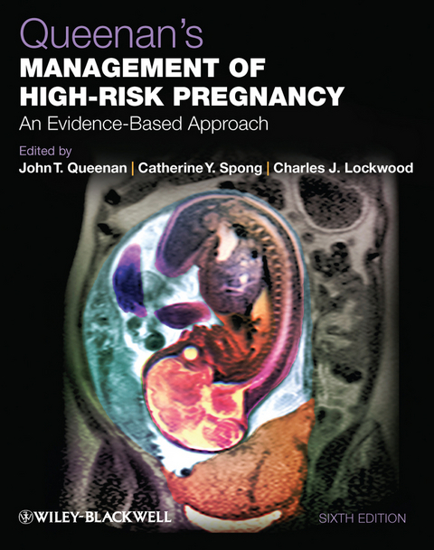 Queenan's Management of High-Risk Pregnancy - 