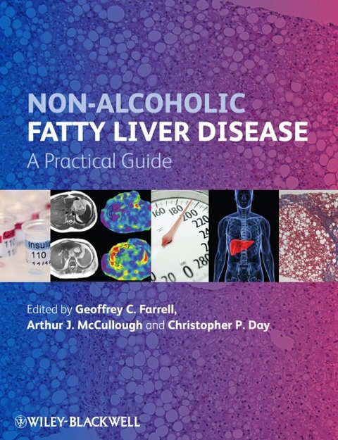 Non-Alcoholic Fatty Liver Disease - 