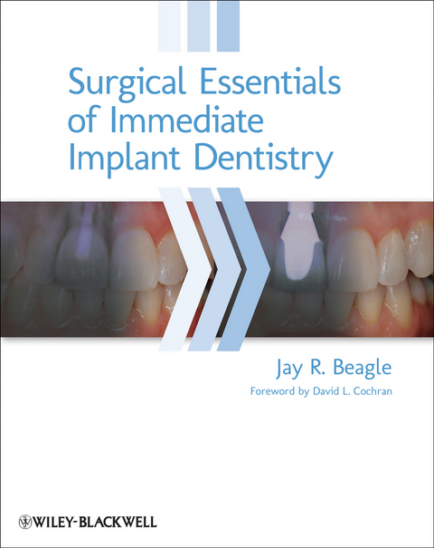 Surgical Essentials of Immediate Implant Dentistry -  Jay R. Beagle